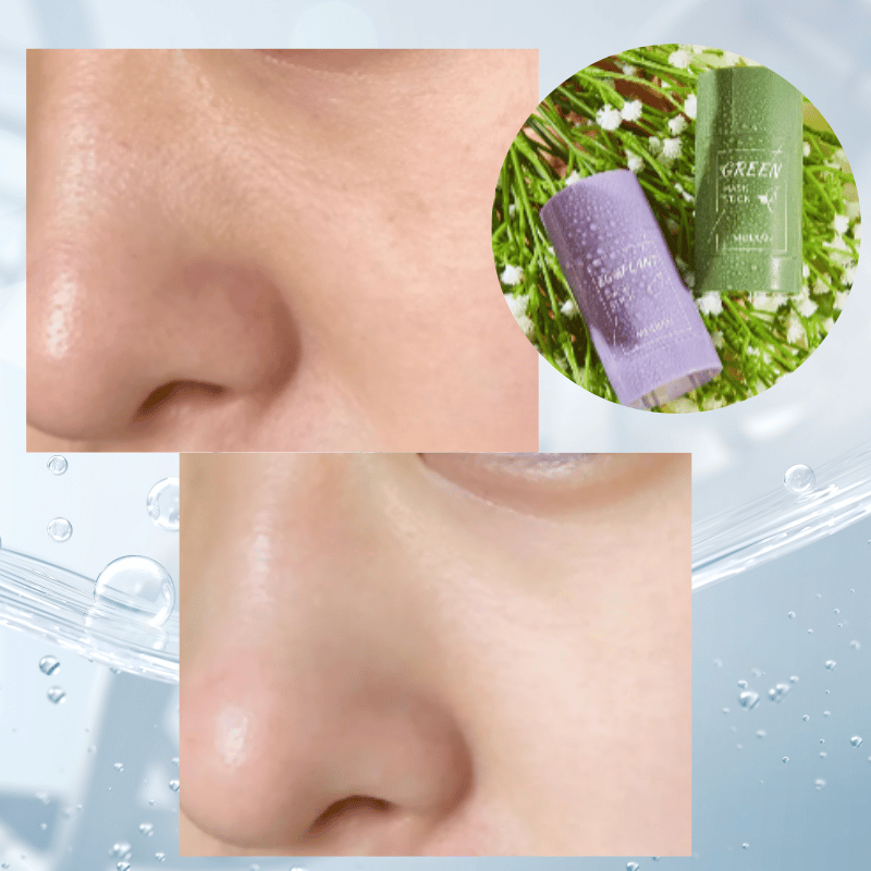 Máscara de limpeza, Controle de oleosidade e Anti Acne